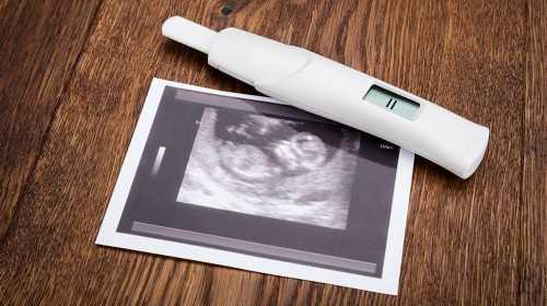 广州代孕的成功概率多少|视角：攀枝花卵巢囊肿可以做三代试管吗