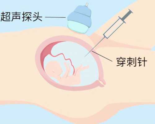 爱维艾夫医院_武汉金宝宝助孕公司|第三代试管婴儿：合肥市计50岁做试管婴儿